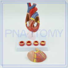PNT-0401 Modelo anatômico coração de equipamentos médicos